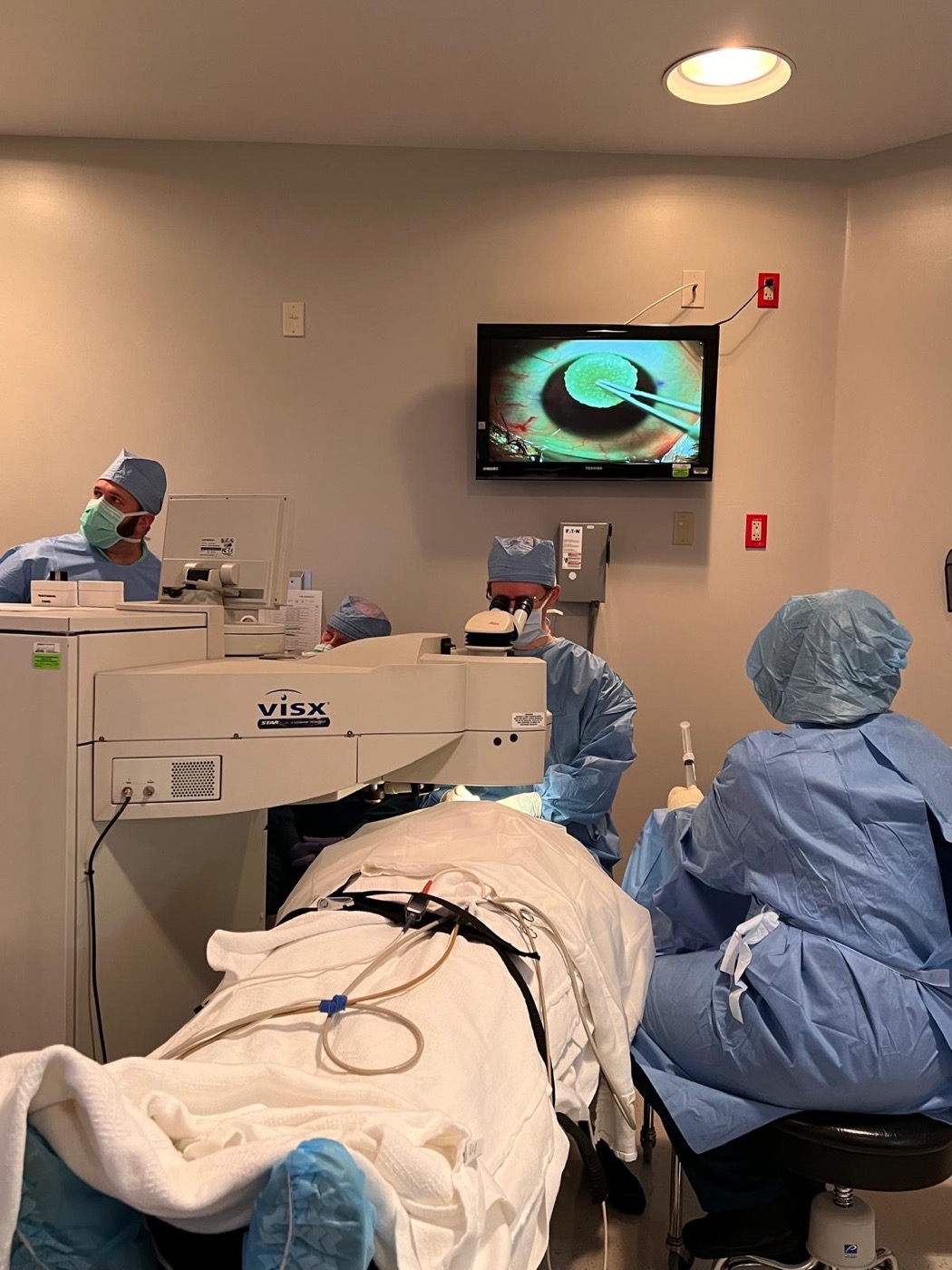 The surgical suite during a laser procedure, the team working at the VISX laser while a live view of the eye is shown on the wall monitor.