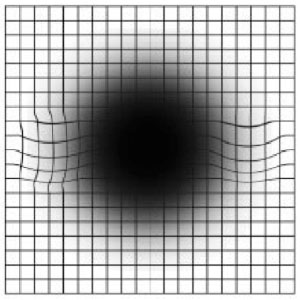 https://www.randeye.com/wp-content/uploads/2017/02/amsler-grid-self-test-sample.jpg